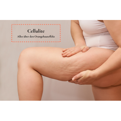 Cellulite – Alles über den...
